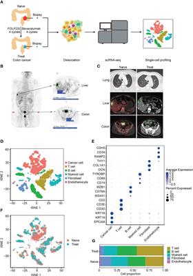 Single-cell analysis reveals cellular reprogramming in advanced colon cancer following FOLFOX-bevacizumab treatment